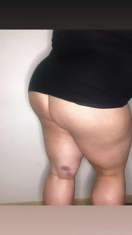Happy Hump Wednesday ... with squat battle wounds 🍑