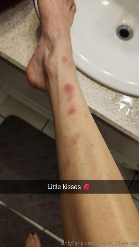 💋💋💋