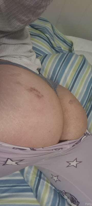 Perdón por la demora. Estuve de relax,aunque por el culo par..