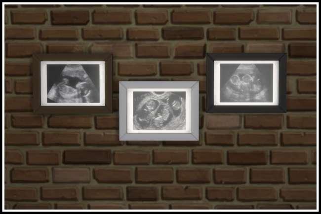 New Mod "Ultrasound Scan"