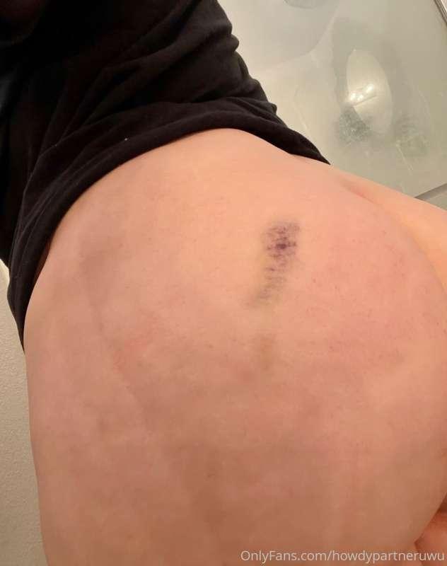 I closed a car door on my ass. I HATE THIS LMAOOOO