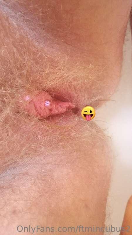 I'm back from the hospital and I'm feeling much better! I gr..