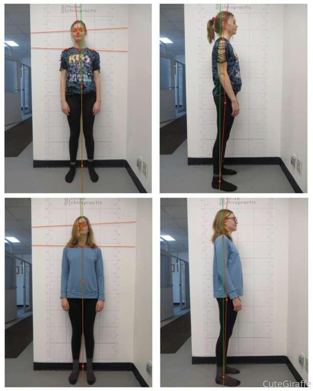 Progress pics from going to the chiro for a month :) top set..