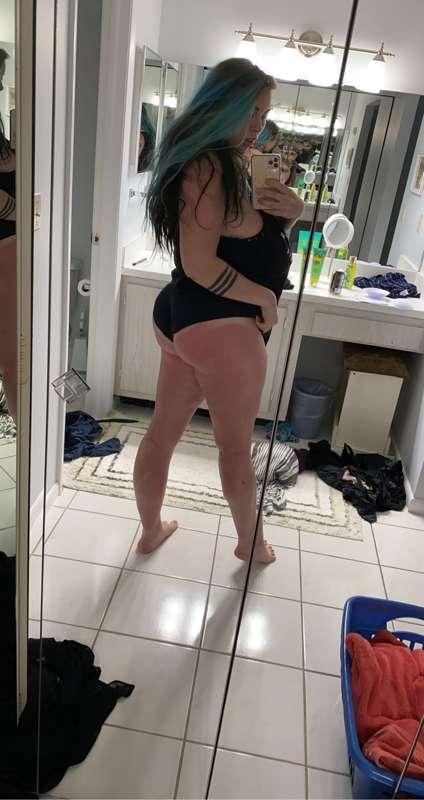 I burned my bum 🥲🦞

HELPPPPP 😭