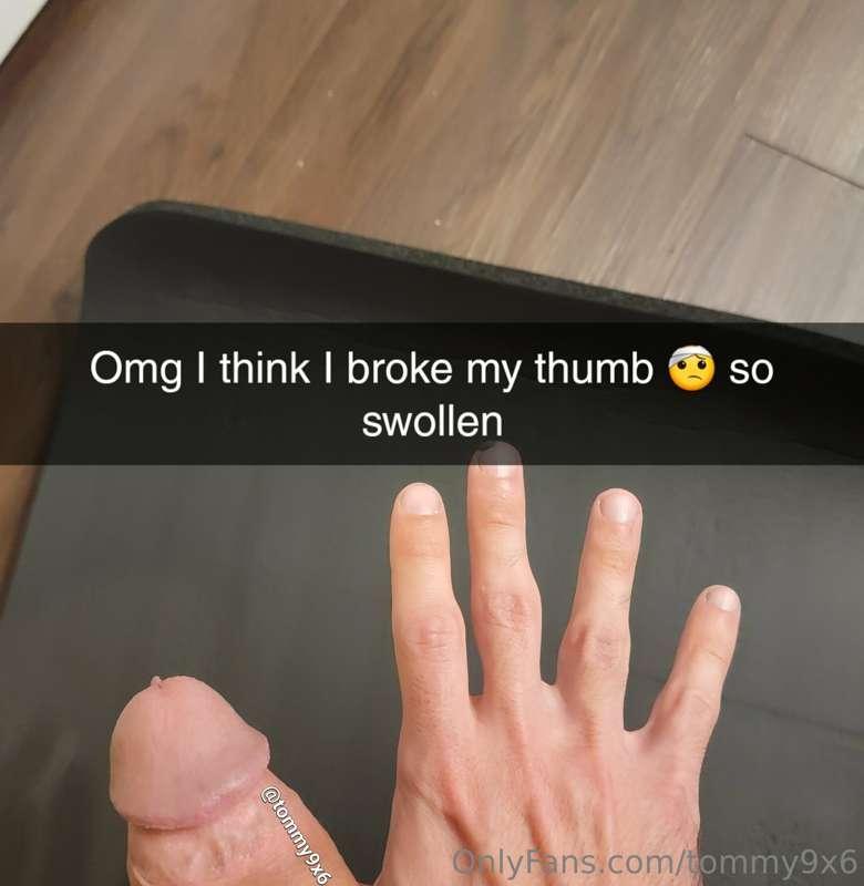 Ouchie 🤕