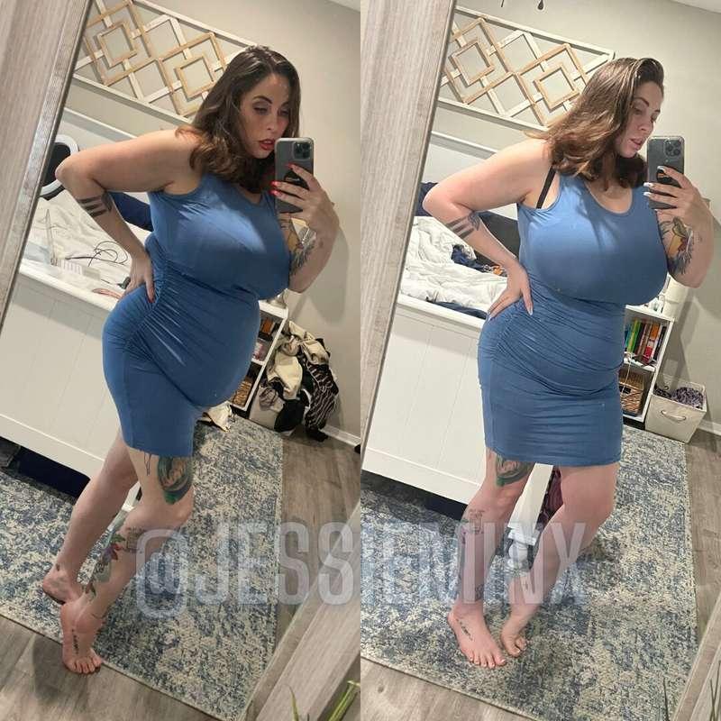 Pre-Op vs 2 Week Post-op

One key difference in these photos..