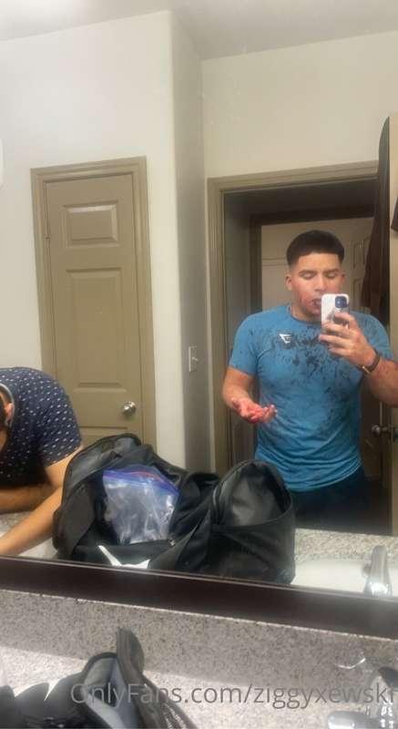 Hey guys sorry I’m not posting Recently got attacked and I’m..