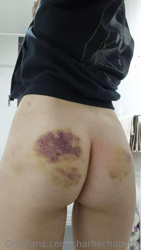 Owww!!! 😭  I was at a kink party over the weekend. Having un..