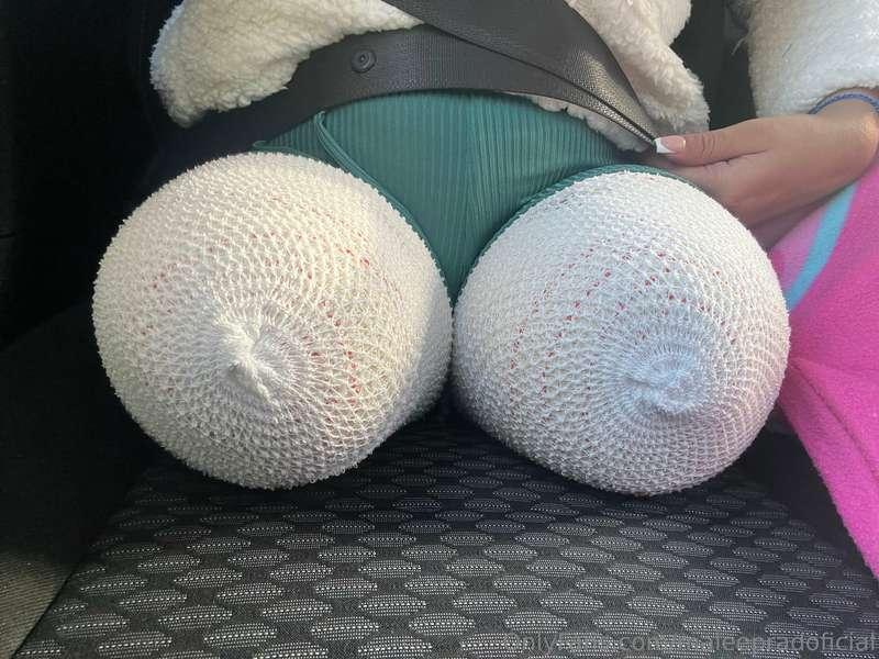 Mi muñones vendados para que cojan forma 🥰 les gusta?