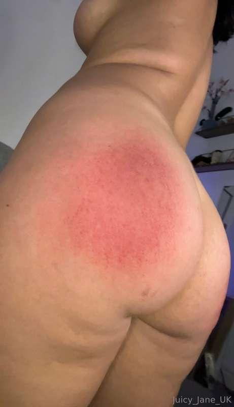 Red like Rudolph’s nose! 

Did you see me do 800 spanks the ..