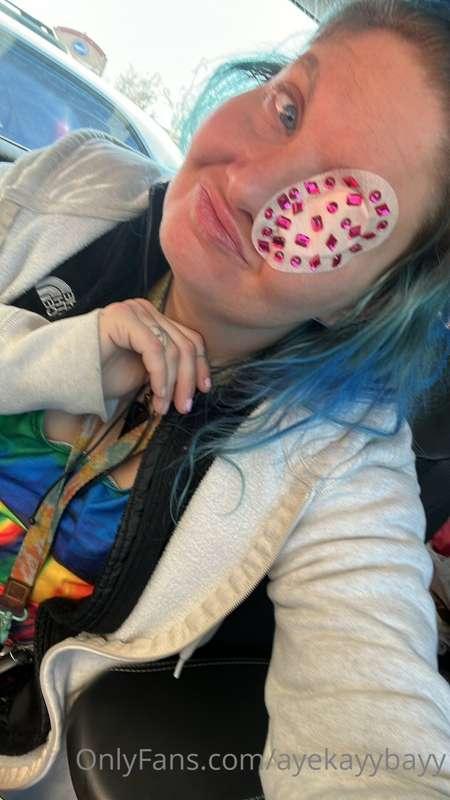 I have a really bad eye infection and I am pretty down. Send..