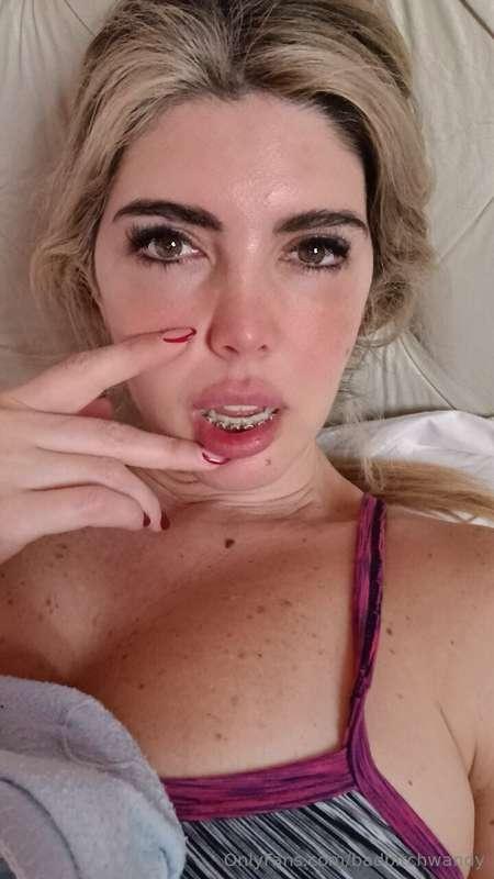  Do you remember what my bottom teeth were like? 