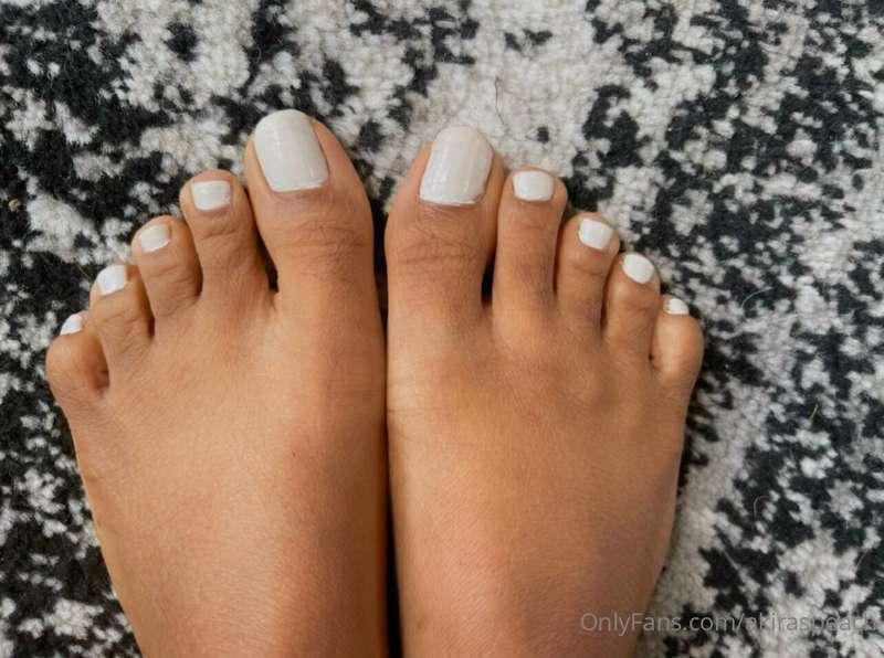 For everyone wondering what my feet look like… I used to hat..