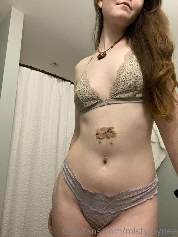 Well i got melanoma & got it removed on Valentine’s Day. It ..