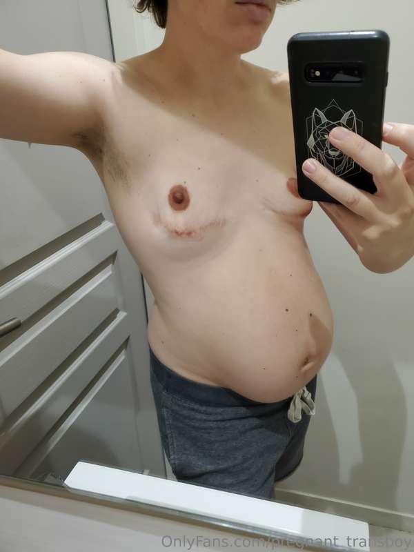 pregnant_transboy image #3