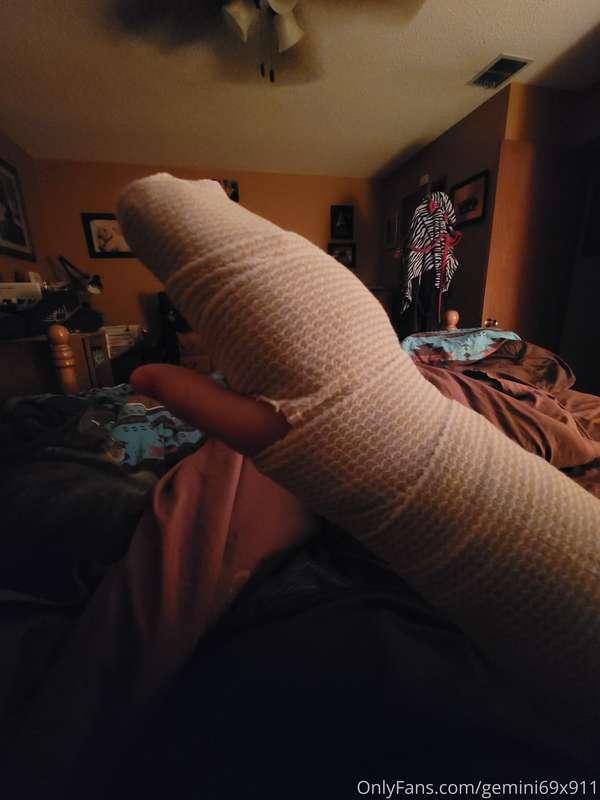 Surgery yesterday...
All this for a severed extensor tendon ..