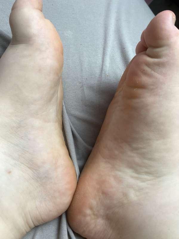 Close Up of my Soles!
