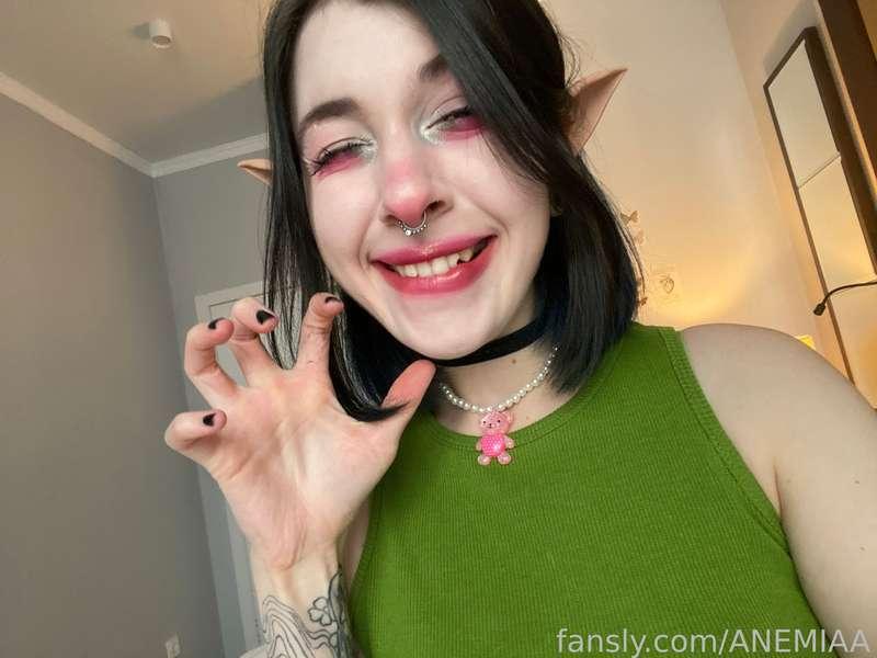 anemiaa image #1