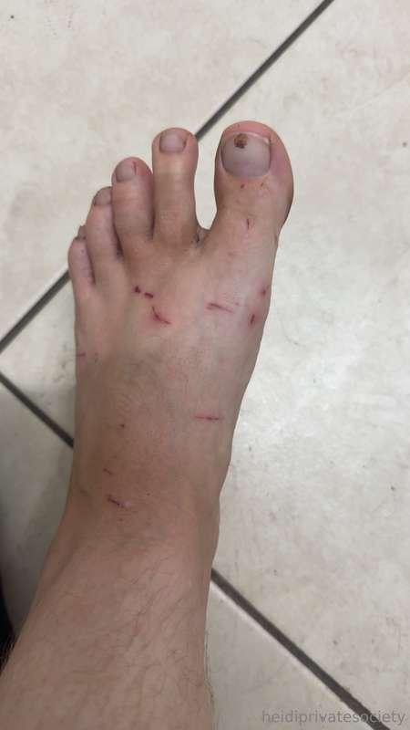Barnacles can be brutal. Don’t take them lightly or wear wat..
