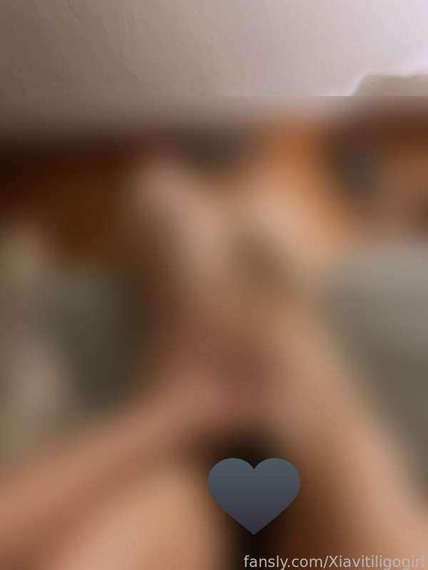 xiavitiligogirl image #0