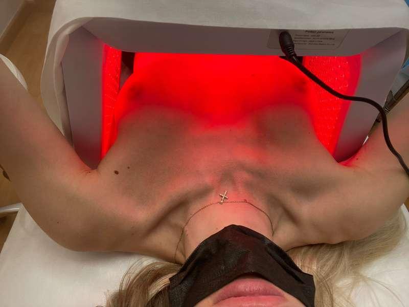 Having a treatment for the scars today! Looks like my boobs ..