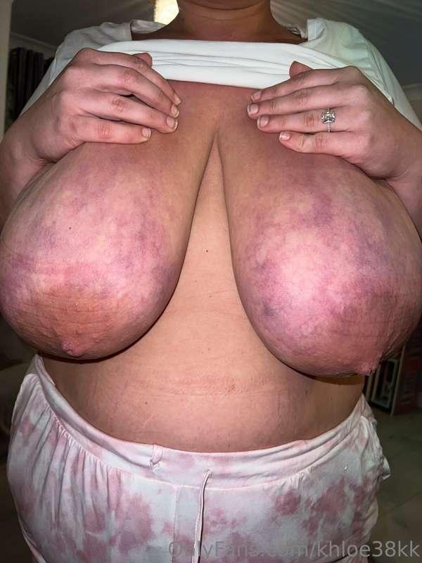 Ouch hehee