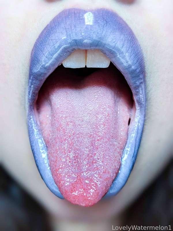 lovelywatermelon1 image #10