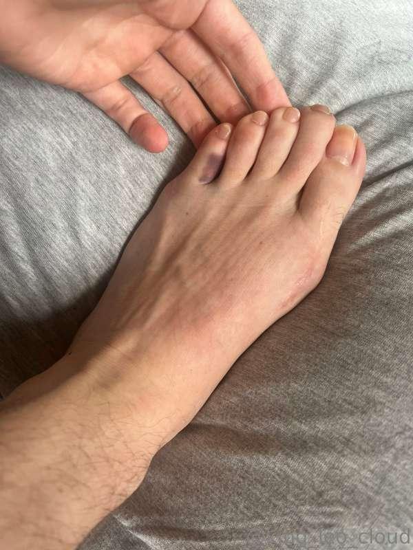I broke my little pink toe this morning 🥲 where are my feet ..