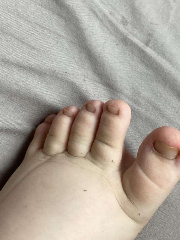 Those Tiny stinky Toes!