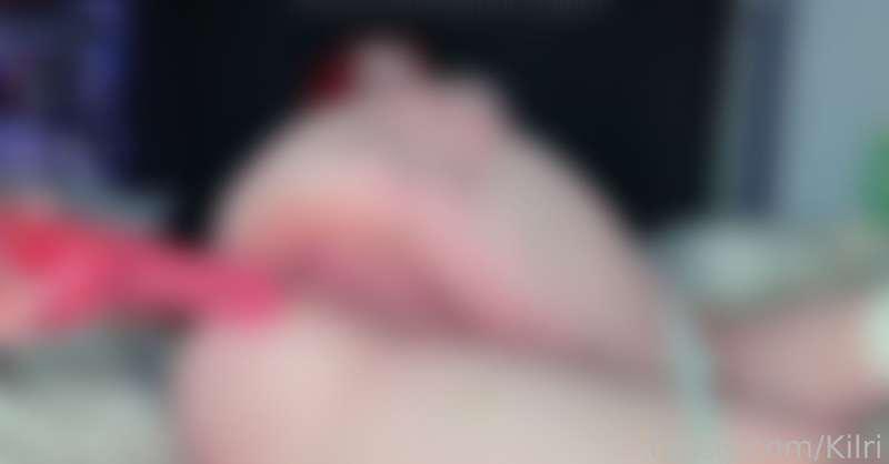 DM