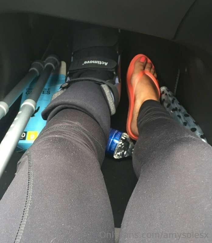 Here’s a Thursday throwback from when I broke my ankle exerc..