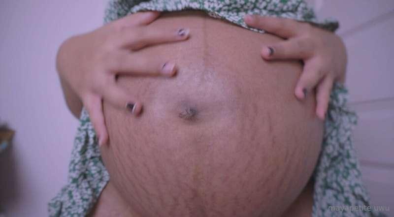stretch marks to die for