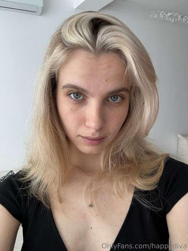Freckles are small pigmented spots on the skin that appear i..