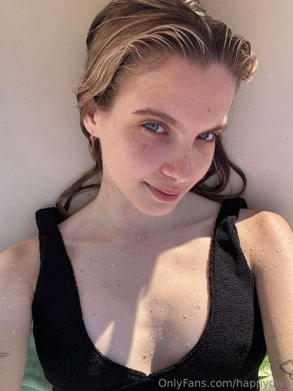 Freckles are small pigmented spots on the skin that most oft..