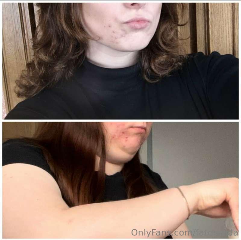 Face weight gain