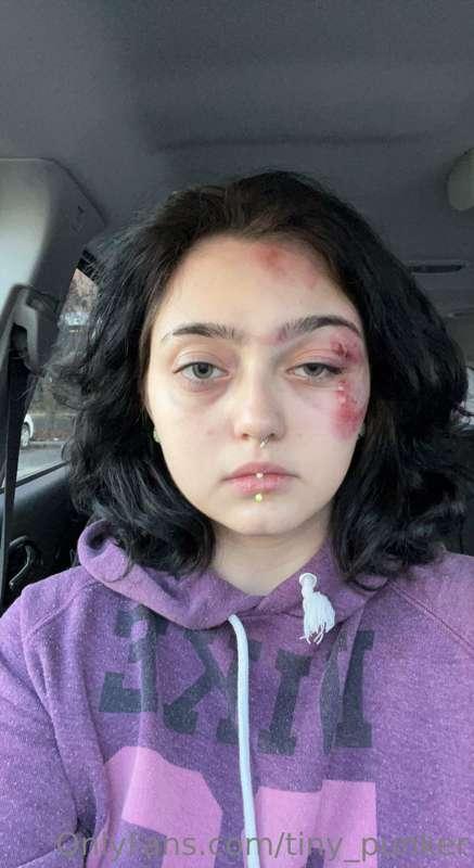 i won't be making content for a bit, i got into a car crash ..