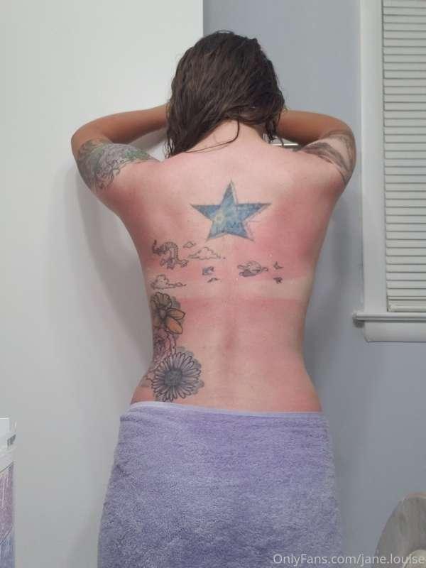 I burned my back at the beach :< if only someone could spray..