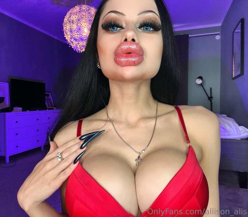 Swollen lips new video💋 30th augmentation 💉 
Biting my lips ..