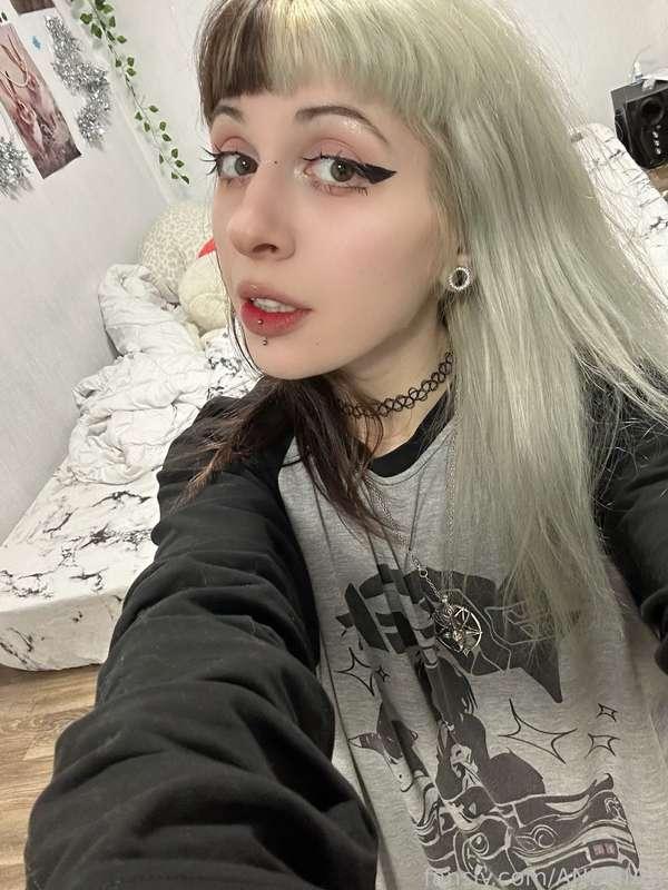 anemiaa image #2