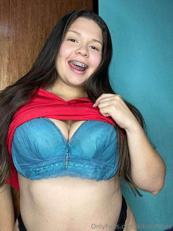 kikisbraces image #3