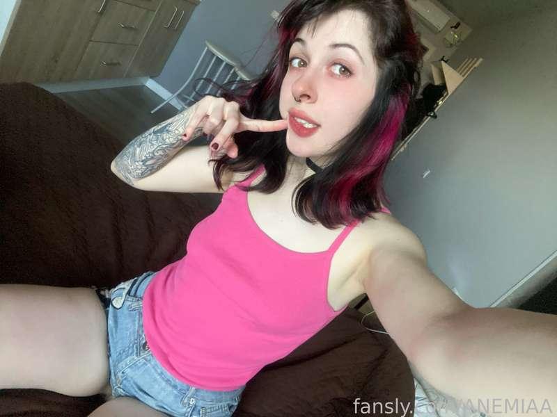 anemiaa image #2
