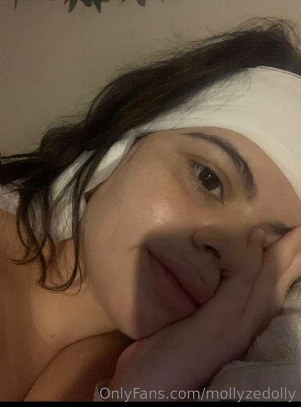 Lol exclusive post op pic!!! Keep me company in the dms! I l..