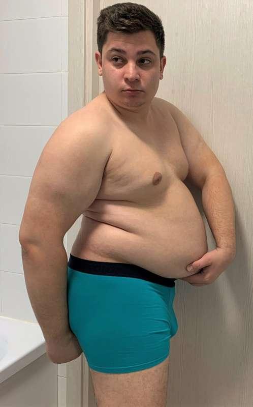 Hanging Belly