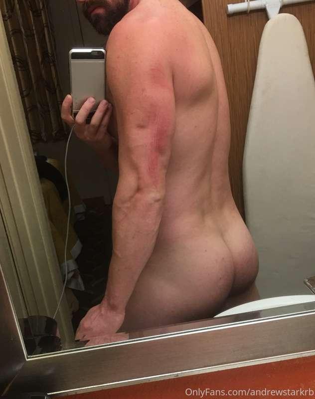 Check out my boo boo!! I think I need first aid. Someone com..