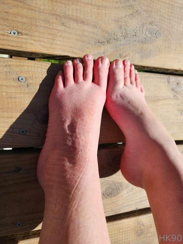 I sat on my feet too long now they are scrunchy and asleeeee..