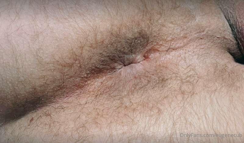 Quality of my iPhone shows a good texture of my hole