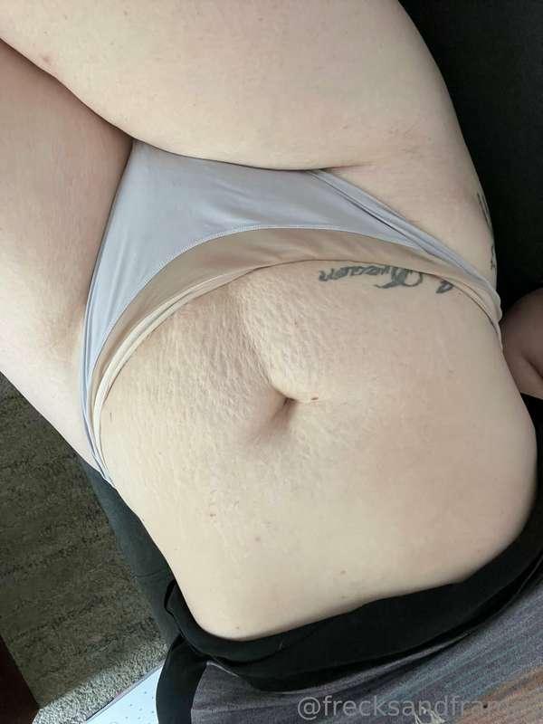 morning tummy because those stretch marks are phenomenal