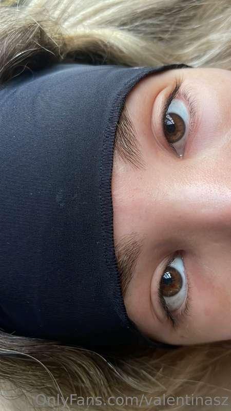 hey guys! I got some plastic surgeries on my face so I'm a l..