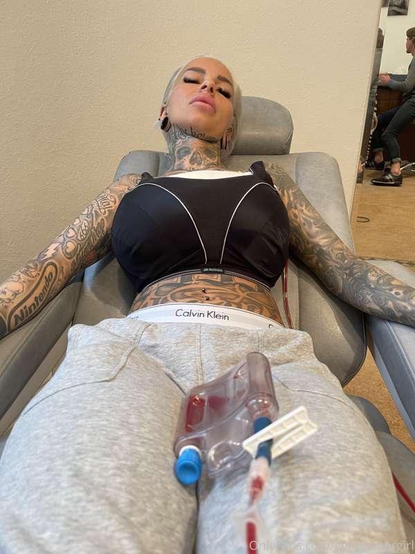 Currently I feel like shit after the surgery .. 😢