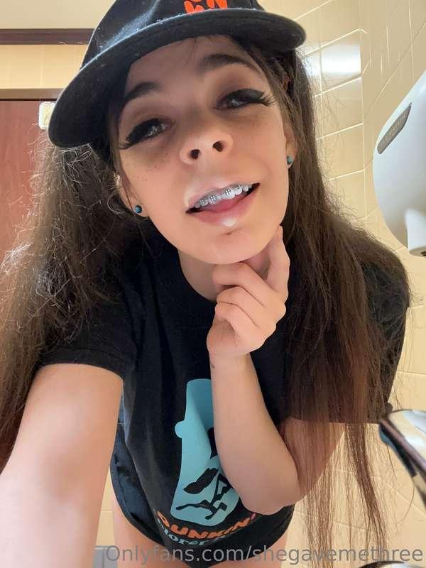Glazed (if u know what i mean) braces
